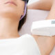 Laser hair removal treatment